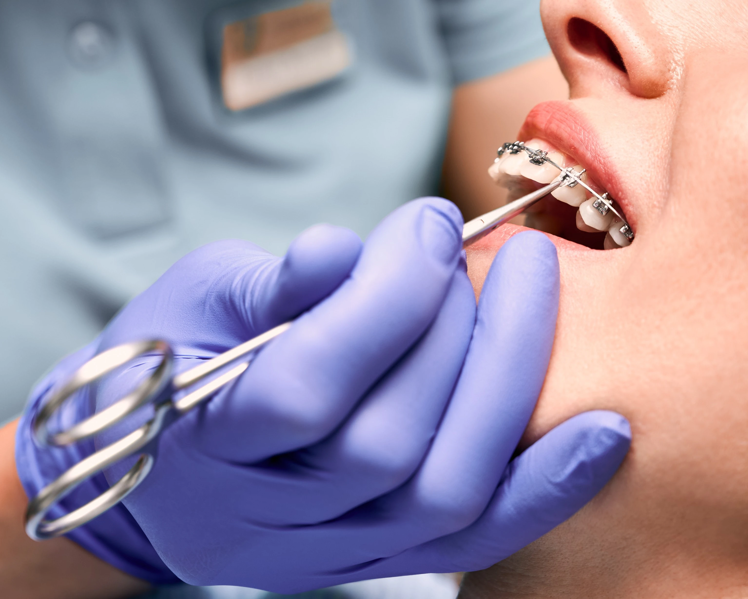 Cosmetic Orthodontics